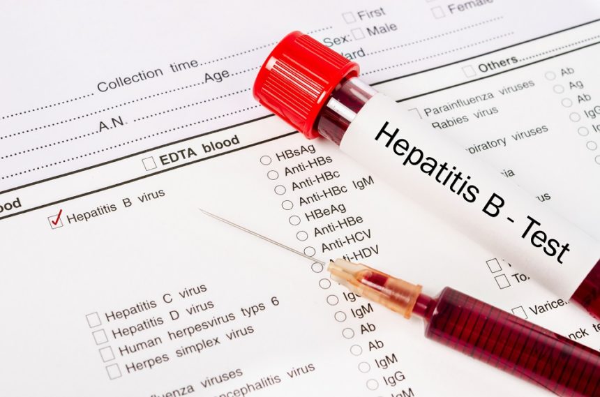 Sample blood in blood tube for hepatitis test